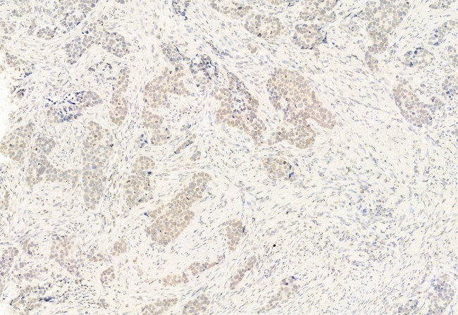 NCOA4 Antibody in Immunohistochemistry (Paraffin) (IHC (P))