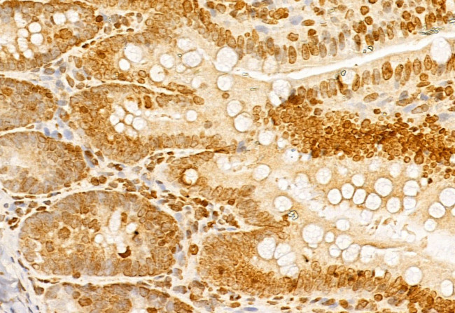 NCOA4 Antibody in Immunohistochemistry (Paraffin) (IHC (P))