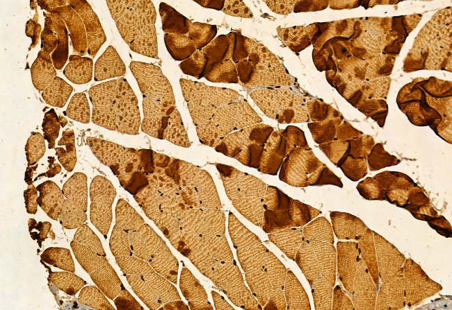 NDE1 Antibody in Immunohistochemistry (Paraffin) (IHC (P))