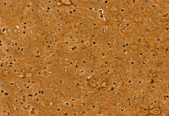 NDE1 Antibody in Immunohistochemistry (Paraffin) (IHC (P))