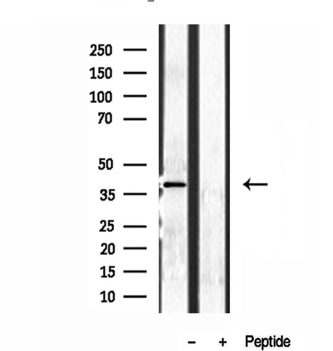 NDE1 Antibody in Western Blot (WB)