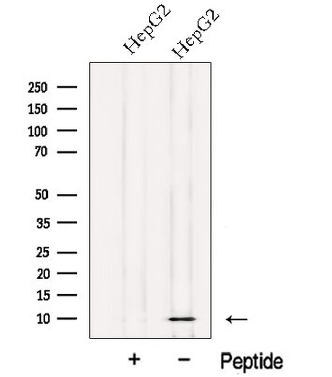 NDUFV3 Antibody in Western Blot (WB)