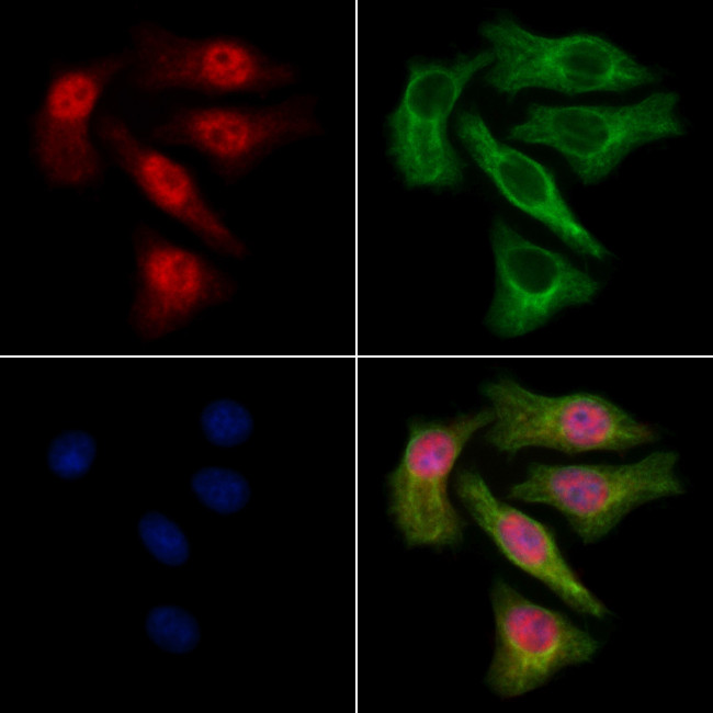 WHSC2 Antibody in Immunocytochemistry (ICC/IF)