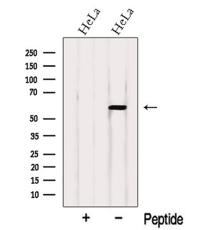 WHSC2 Antibody in Western Blot (WB)