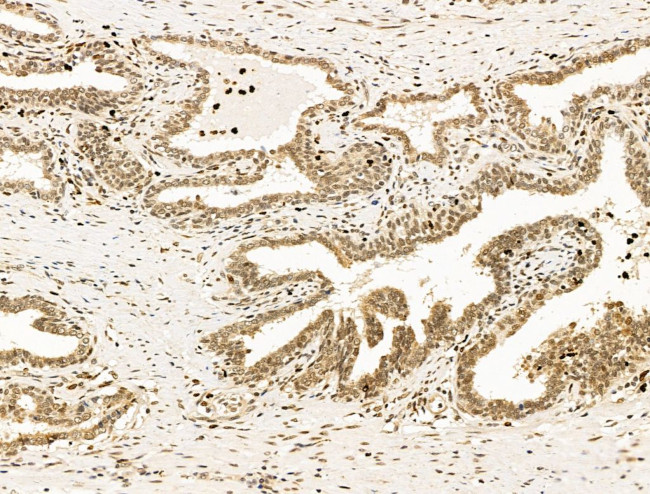 Nesprin 1 Antibody in Immunohistochemistry (Paraffin) (IHC (P))