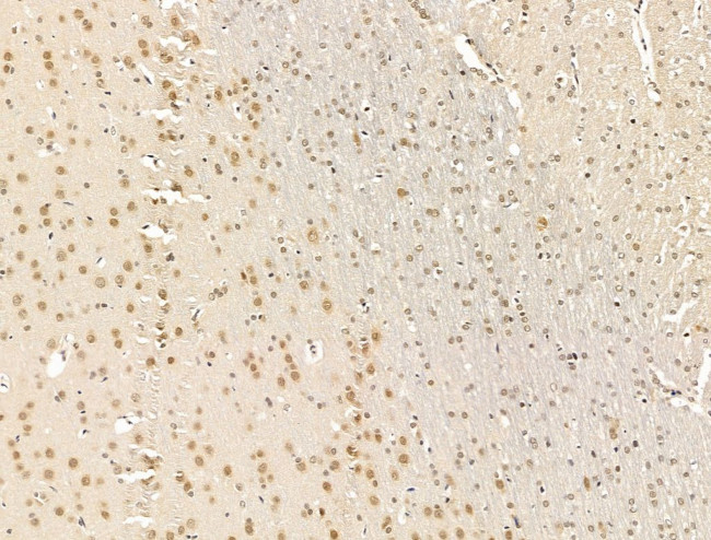 Nesprin 1 Antibody in Immunohistochemistry (Paraffin) (IHC (P))