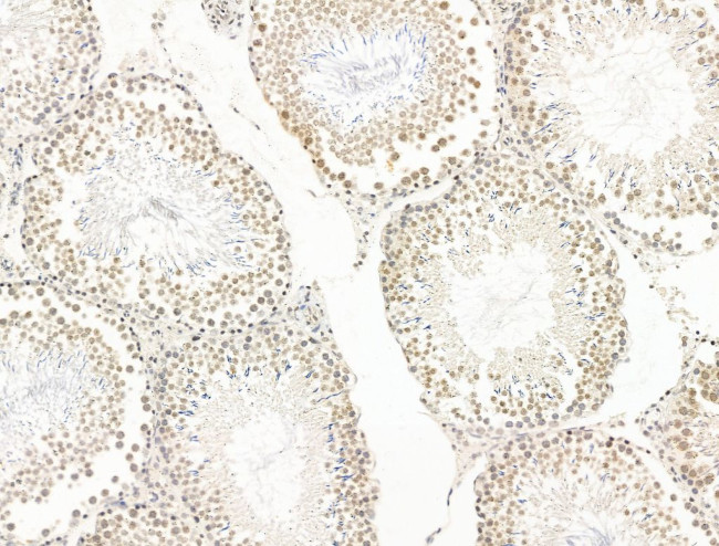 Nesprin 1 Antibody in Immunohistochemistry (Paraffin) (IHC (P))