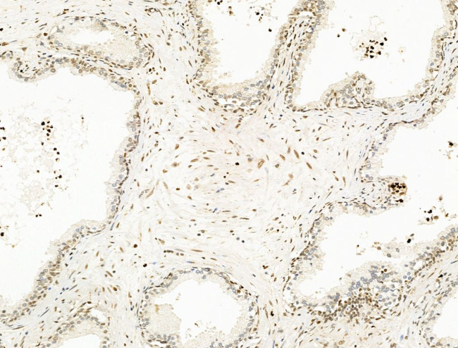 Nesprin 1 Antibody in Immunohistochemistry (Paraffin) (IHC (P))