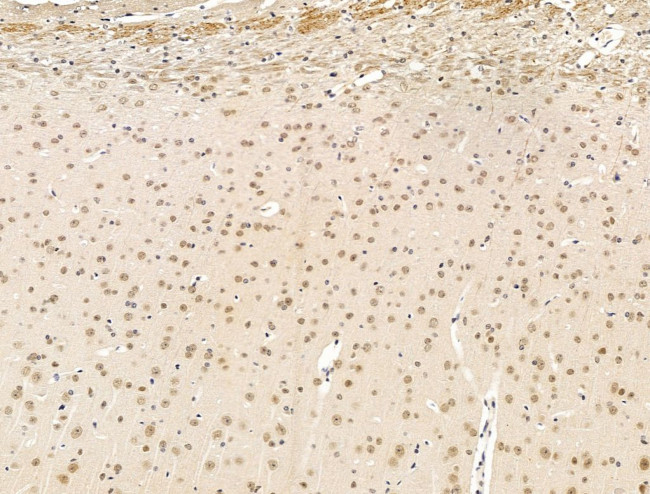 Nesprin 1 Antibody in Immunohistochemistry (Paraffin) (IHC (P))