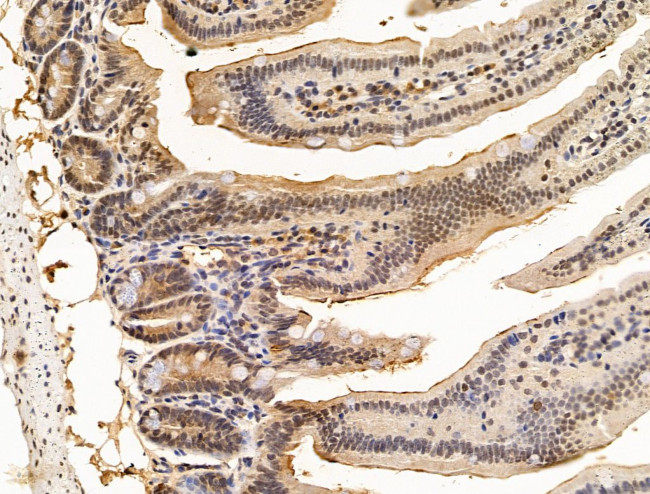 Nesprin 1 Antibody in Immunohistochemistry (Paraffin) (IHC (P))