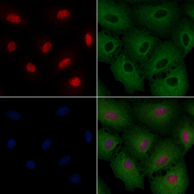 NeuN Antibody in Immunocytochemistry (ICC/IF)