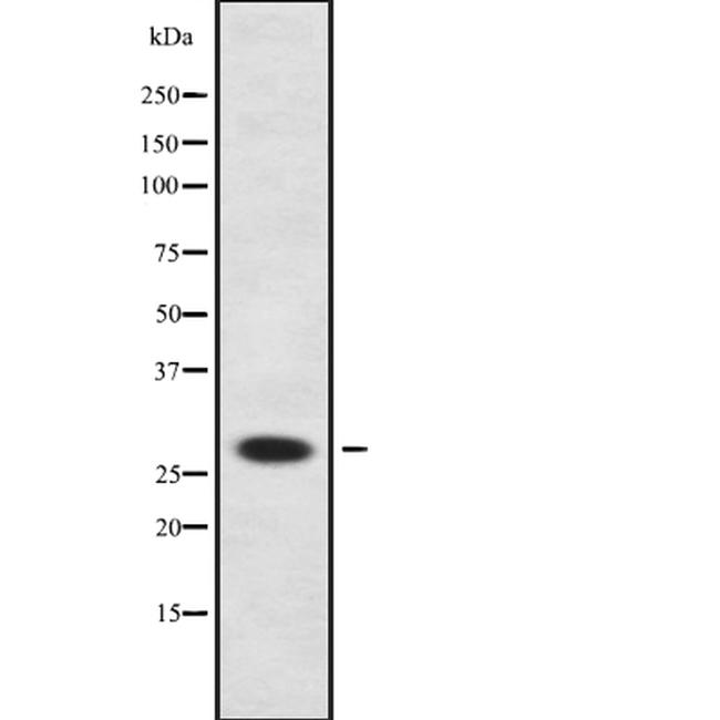 Neurogenin 2 Antibody in Western Blot (WB)