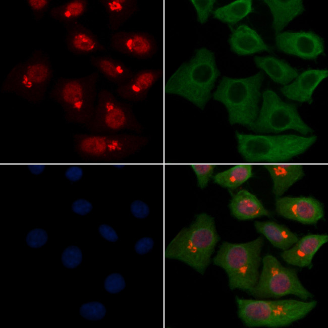 Neutrophil elastase Antibody in Immunocytochemistry (ICC/IF)