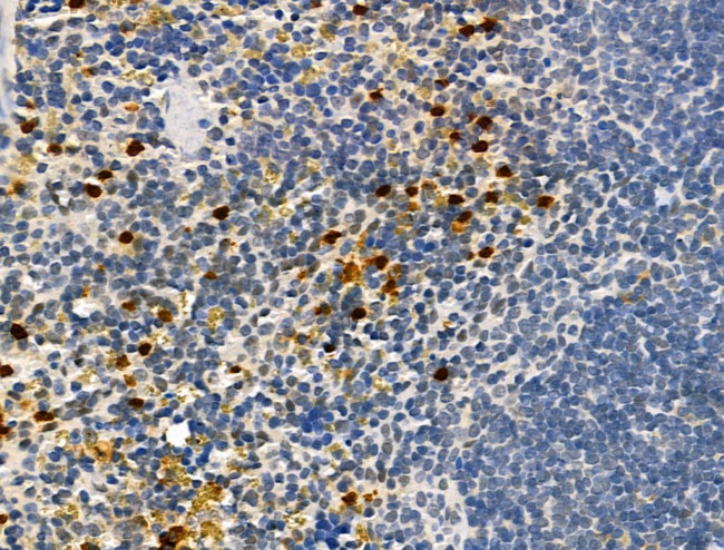 Neutrophil elastase Antibody in Immunohistochemistry (Paraffin) (IHC (P))