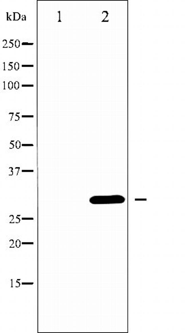 Neutrophil elastase Antibody in Western Blot (WB)