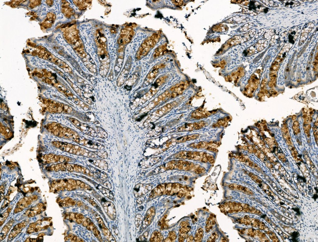 CHRNA7 Antibody in Immunohistochemistry (Paraffin) (IHC (P))