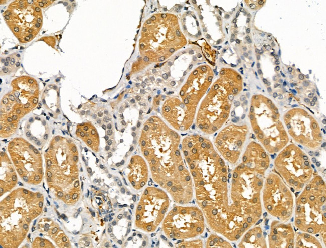 CHRNA7 Antibody in Immunohistochemistry (Paraffin) (IHC (P))