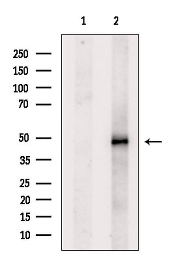 CHRNA7 Antibody in Western Blot (WB)