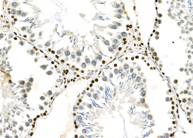 NKAP Antibody in Immunohistochemistry (Paraffin) (IHC (P))