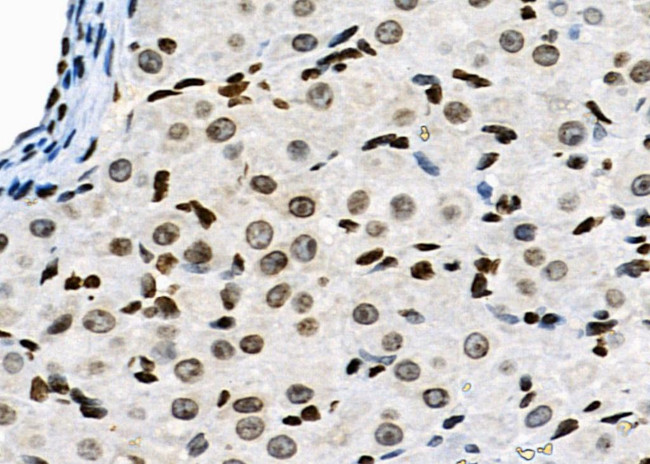 NKAP Antibody in Immunohistochemistry (Paraffin) (IHC (P))