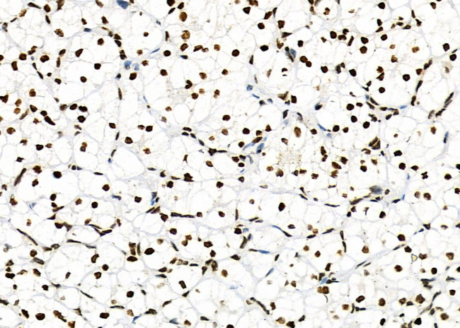 NKAP Antibody in Immunohistochemistry (Paraffin) (IHC (P))