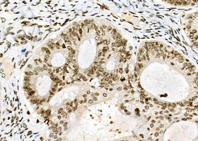 NKAP Antibody in Immunohistochemistry (Paraffin) (IHC (P))