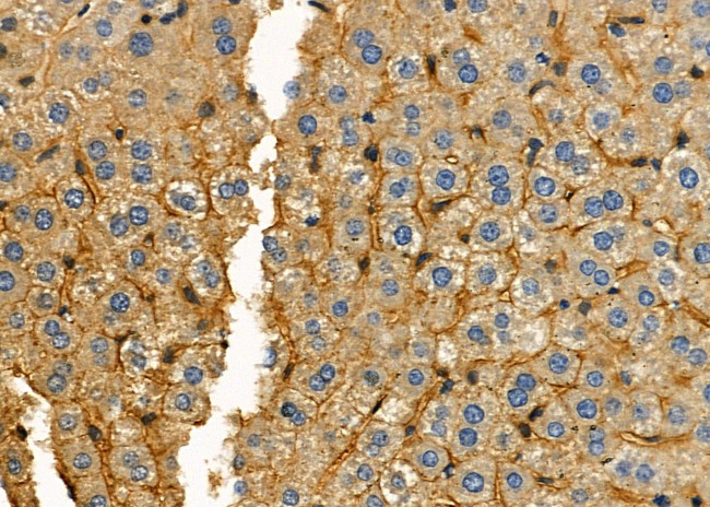 NKTR Antibody in Immunohistochemistry (Paraffin) (IHC (P))