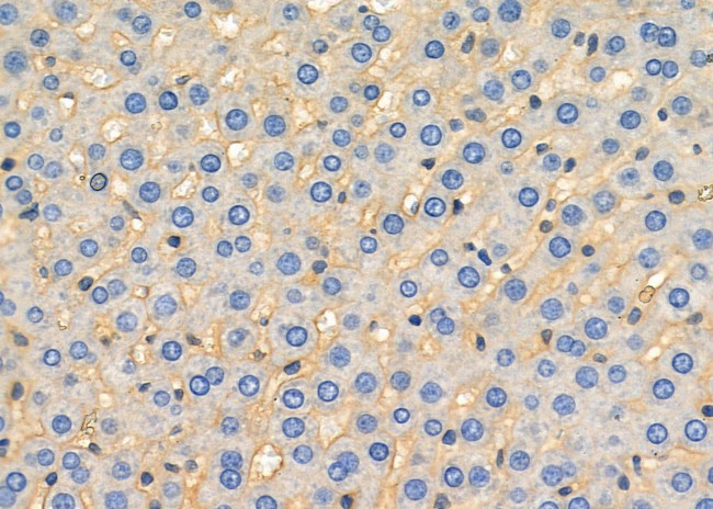 NKTR Antibody in Immunohistochemistry (Paraffin) (IHC (P))