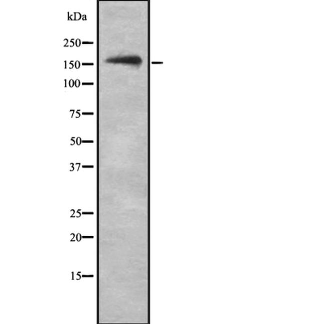 NKTR Antibody in Western Blot (WB)