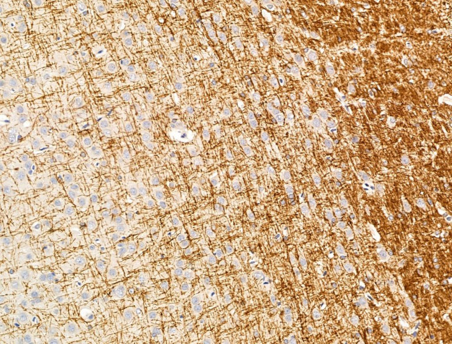 NOD4 Antibody in Immunohistochemistry (Paraffin) (IHC (P))