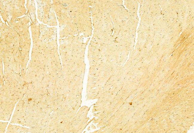 NLRP3 Antibody in Immunohistochemistry (Paraffin) (IHC (P))