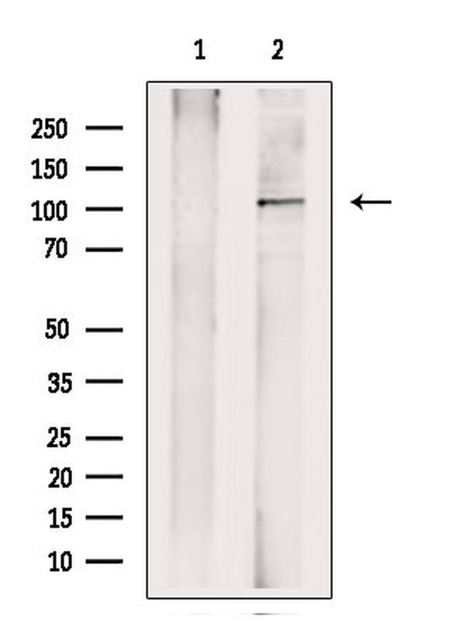 NLRP3 Antibody in Western Blot (WB)