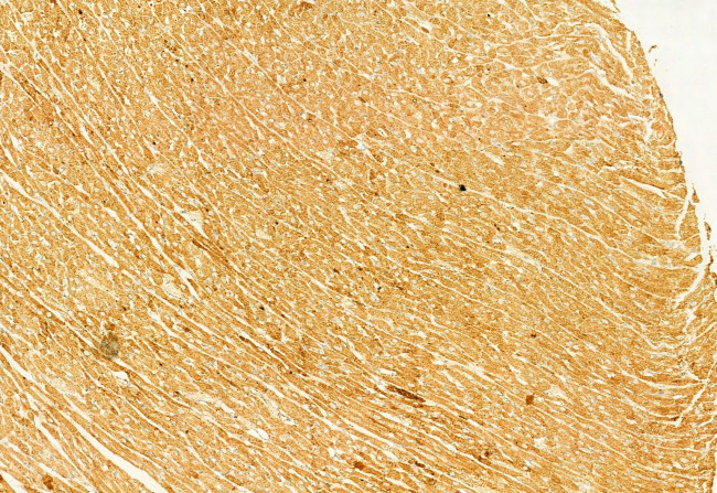 NLRP3 Antibody in Immunohistochemistry (Paraffin) (IHC (P))