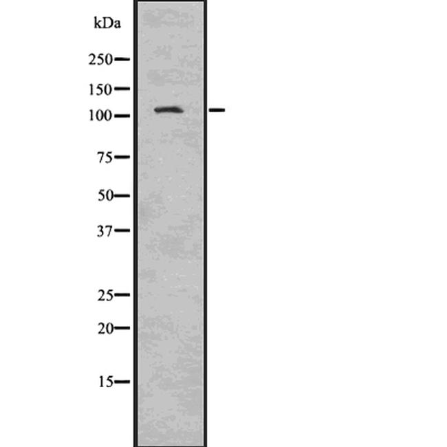 NLRP3 Antibody in Western Blot (WB)