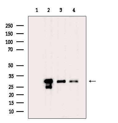 NQO1 Antibody in Western Blot (WB)