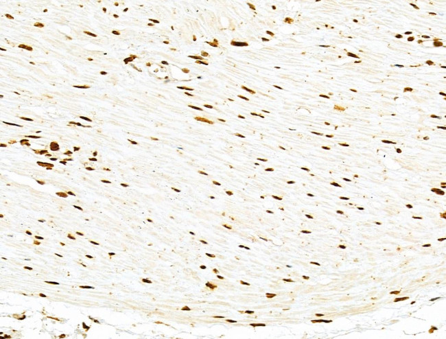 PXR Antibody in Immunohistochemistry (Paraffin) (IHC (P))