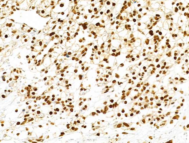 PXR Antibody in Immunohistochemistry (Paraffin) (IHC (P))