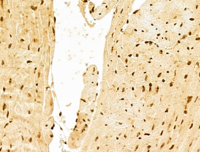 PXR Antibody in Immunohistochemistry (Paraffin) (IHC (P))