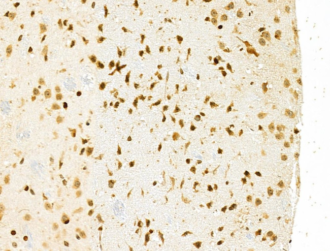 PXR Antibody in Immunohistochemistry (Paraffin) (IHC (P))