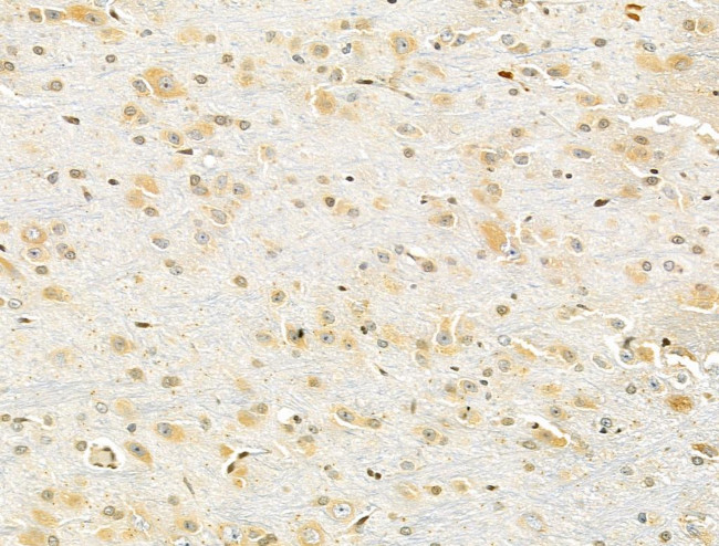 PXR Antibody in Immunohistochemistry (Paraffin) (IHC (P))