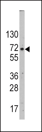 GLUT2 Antibody in Western Blot (WB)