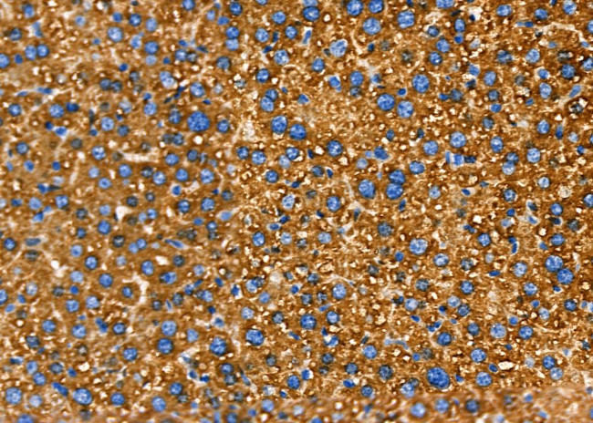 N-Ras Antibody in Immunohistochemistry (Paraffin) (IHC (P))