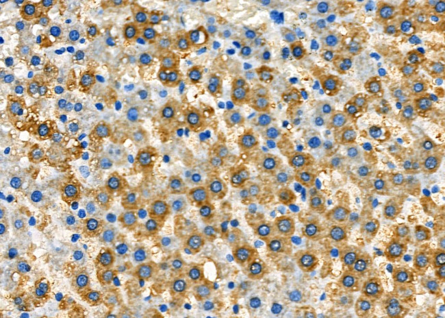 N-Ras Antibody in Immunohistochemistry (Paraffin) (IHC (P))