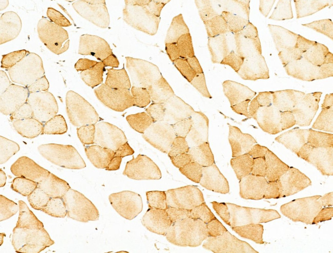 NFE2L2 Antibody in Immunohistochemistry (Paraffin) (IHC (P))