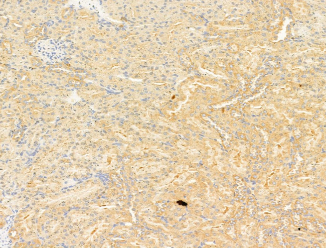 NFE2L2 Antibody in Immunohistochemistry (Paraffin) (IHC (P))