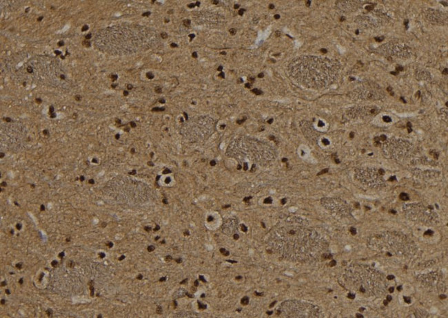 NSUN2 Antibody in Immunohistochemistry (Paraffin) (IHC (P))