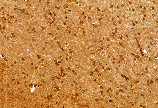 NSUN2 Antibody in Immunohistochemistry (Paraffin) (IHC (P))