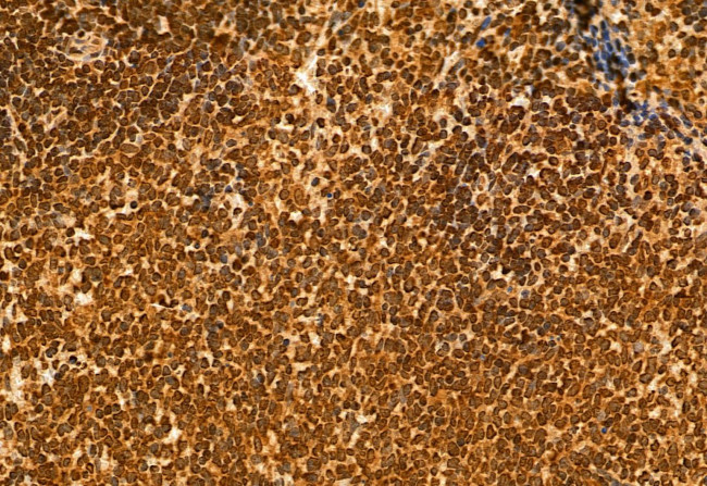 NSUN2 Antibody in Immunohistochemistry (Paraffin) (IHC (P))