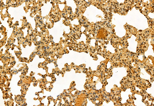 NSUN2 Antibody in Immunohistochemistry (Paraffin) (IHC (P))