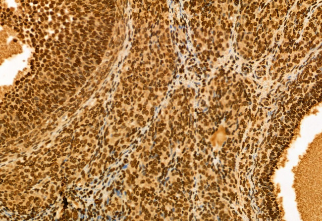 NSUN2 Antibody in Immunohistochemistry (Paraffin) (IHC (P))